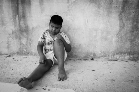 Little boy scratching the blisters scab on leg,focus legの写真素材