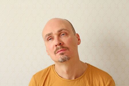 Young man in a beige T-shirt sits with a sick look, closeup. Sore eyes, tired look, burnout. Fatigue from work. Portrait.の写真素材