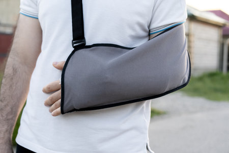 An individual stands outside, wearing a gray arm sling. The sling supports their injured arm. The background features buildings and greenery, indicating a suburban environment.の写真素材