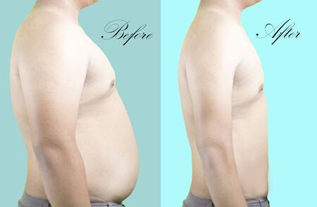 diet before after Men picturesの写真素材