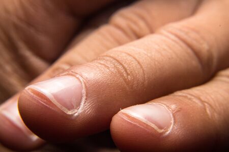 Macro fingerの写真素材