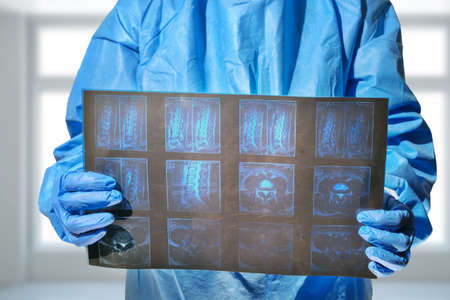 A doctor hands holding and analyzes spine radiography X-rayの写真素材