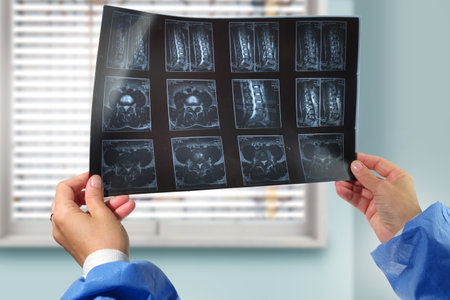 A doctor hands holding and analyzes spine radiography X-ray