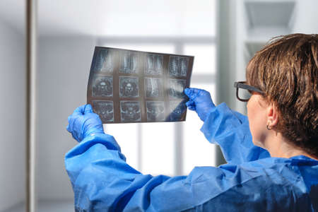 Female doctor holding and analyzes spine radiography X-rayの写真素材
