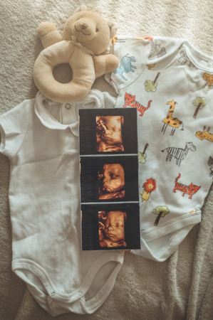 Little hand made baby clothes. Photo of ultrasound. newborn clothes on beige woolen background. Unity, protection and happinessの写真素材