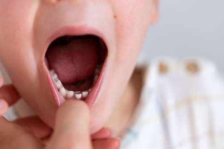 Children shark teeth, first tooth that appears in childhood behind baby teeth.の写真素材