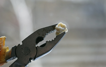 ripped out a rotten tooth in an old rusty pliersの写真素材