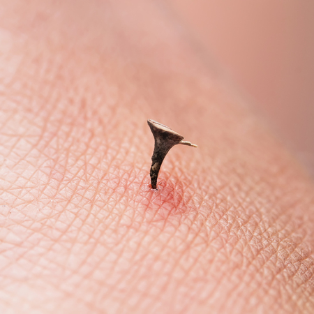 A dirty strong, acute and sharp plant thorn pierced on human skin