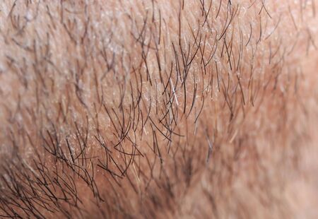 background with masculine skin texture covered with fine and coarse hairs and bristles and scalesの写真素材