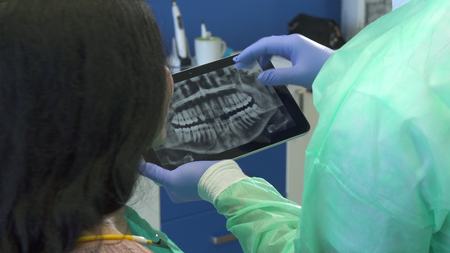 Dentist zooms x-ray image on his tabletの写真素材