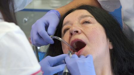 Dentist polishes clients lower teethの写真素材
