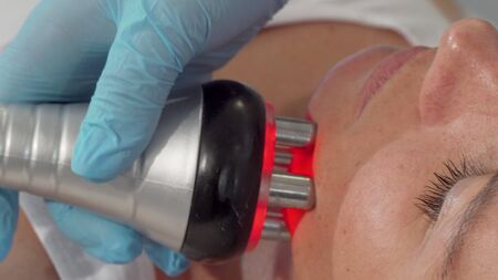 Sliding cropped shot of a mature woman getting facial rf-lifting procedure
