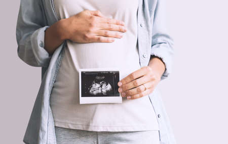 Pregnant woman holding ultrasound baby image. Close-up of pregnant belly and sonogram photo in hands...