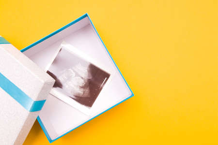 ultrasound picture in a silver box with a blue ribbon and yellow flower yellow background place copy top view, woman pregnant with boy or girl, surprise, photo as a gift, pregnancy conceptの写真素材