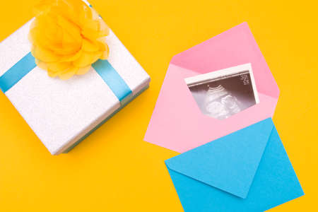 a picture of an ultrasound in a pink envelope, next to it is a silver box and a blue envelope with a blue ribbon and a yellow flower made of fabric, yellow background copy space top view, pregnancy by a girl, expecting a newbornの写真素材