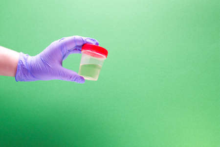 hand in a disposable medical glove holds a jar for analysis with urine, green background, copy spaceの写真素材