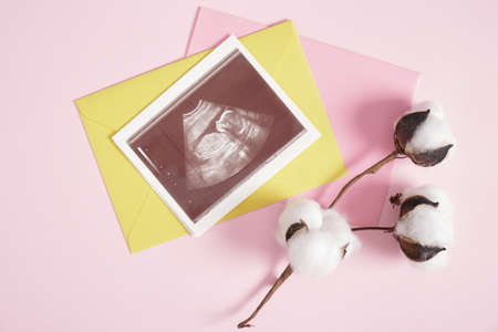 snapshot of an ultrasound scan in a yellow envelope on a pink background, cotton flower gift box and ribbon for decor, pregnancy and motherhood conceptの写真素材