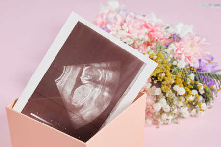 a snapshot of an ultrasound scan and flowers on a pink background pregnancy and motherhood concept, conscious parenthood, the joy of having a child in the familyの写真素材
