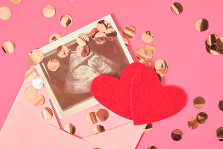 two red felt hearts, a pink envelope with an ultrasound image on a pink background with golden...