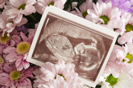 chrysanthemum flowers and snapshot of an ultrasound scan and envelpoe copy spaceの写真素材