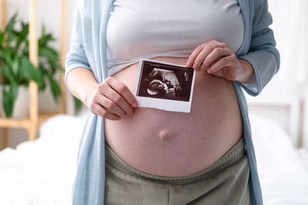 Top view cropped of pregnant woman with ultrasound photo of fetus standing at home, young future mom waiting child first baby, pregnancy and motherhood conceptの写真素材