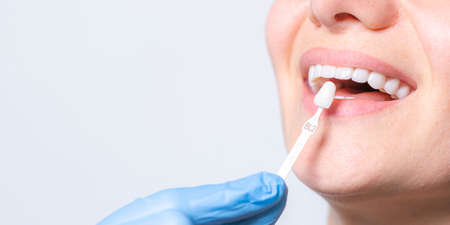 Banner tooth whitening, perfect white teeth close up with shade guide bleach color, female veneer...