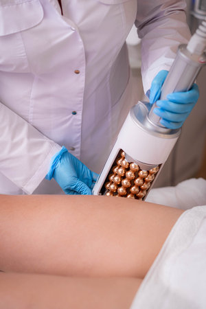 Deep Cellulite Reduction, Massage professional endosphere therapy session, close up view of therapist applying endosphere device on woman in modern clinic, body contouring, skin rejuvenation, beautyの写真素材