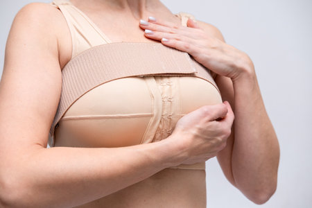 woman patient In post surgical Compression bra, implants stabilizer bra after plastic surgery medical mammoplasty, mastopexy breast enlargement, on white backgroundの写真素材