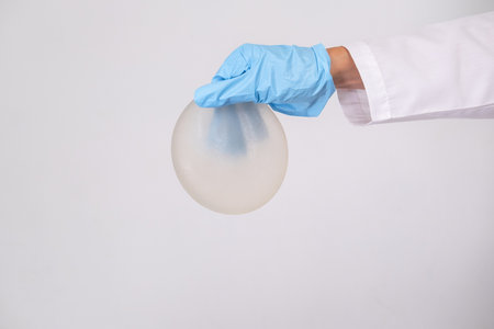 doctor holding breast enlargement implant in hands, plastic surgery concept, beauty enhancement, medical Mammoplasty and plastic surgery, mastopexyの写真素材