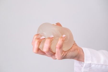 doctor squeezes in his hand breast enlargement implant, plastic surgery, beauty enhancement, medical Mammoplasty and plastic surgery, mastopexyの写真素材