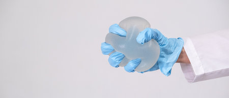 doctor squeezes in his hand breast enlargement implant, plastic surgery, beauty enhancement, medical Mammoplasty and plastic surgery, mastopexyの写真素材