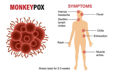 A banner with the monkey pox virus to inform and warn. Symptoms of the monkey virus. vector...