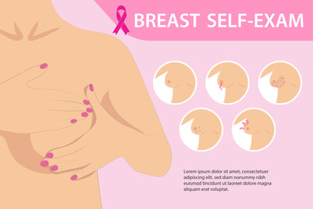 Self-examination for breast cancer, prevention and diagnosis for life.A symptom of breast cancer. Warning signs and danger, unusual changes and pain. Information posterのイラスト素材