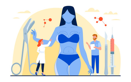 Medical liposuction surgery, beauty procedure for fat removal and weight loss in hospital vector illustration. Cartoon woman model in bikini with lines for slimming on body and tiny doctors treatmentのイラスト素材