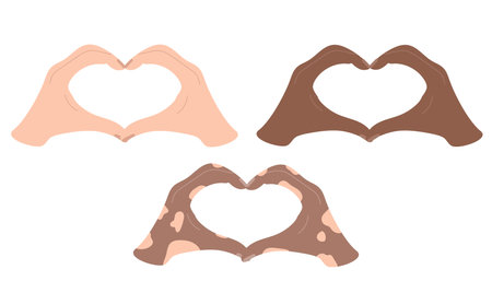 Love sign made with two hands isolated on white background. White, dark, vitiligo skin. Concept of love, support, diversity. Happy saint Valentines day, romantic, coupleのイラスト素材