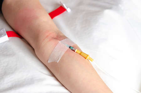 Intravenous drip in the hospital emergency room for first aid. healthの写真素材