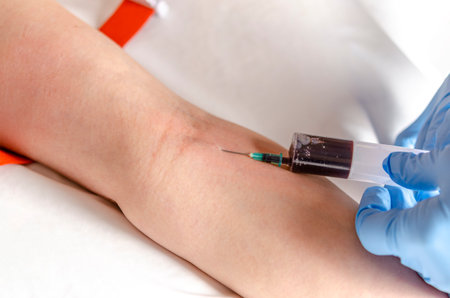 Nurse with syringe in hands. Blood test from a vein.の写真素材
