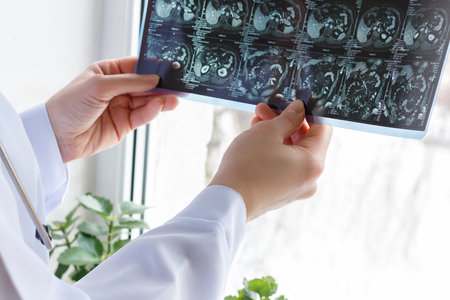 Doctor looks at x-ray the patient.の写真素材