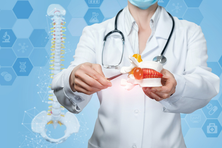 Doctor is pointing at the vertebrae hernia on a blue background.の写真素材