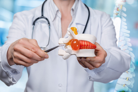 A closeup of a physician with a stethoscope pointing at an inflammation of artificial herniated disc model with tweezers at spin skeleton image background.の写真素材