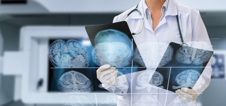 Concept of diagnosing and treating the brain using x-ray equipment.の写真素材