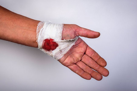 A woman holds a dirty bandaged hand with a bloodstain on a gray background.の写真素材