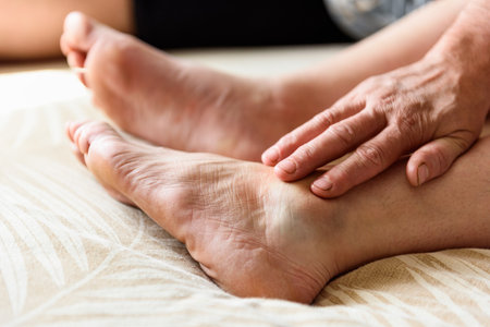 Woman's inflamed, swollen foot from a bruise on a bed at homeの写真素材