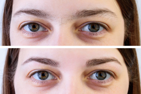 Young girl before and after treatment, eyebrow correction on gray background. Collage before and...