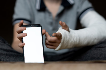 Cropped close-up shot of a boy with a broken arm wrapped in a white plaster cast. Teenager uses phone, white chromakeyの写真素材