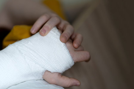 A teenage boy with a broken arm wrapped in a white plaster cast resting on the bed