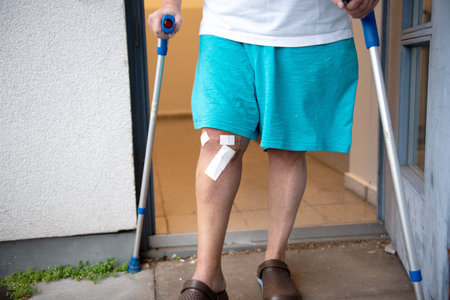 A person's leg after knee surgery