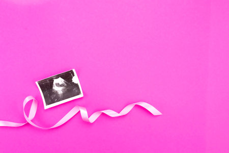 Ultrasound image of a baby with a pink ribbon on a pink background with place for text.