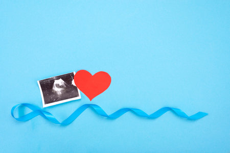 Ultrasound image of a child with a blue ribbon and a snrd on a blue background with place for text.
