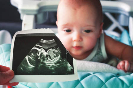 Ultrasound image at the 20th week of pregnancy in the foreground. In the background is a 6 month old baby. Before and now. Selective focusの写真素材
